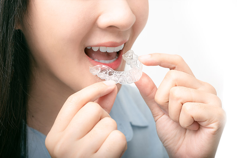 Mark Luzania, DDS Dental Offer